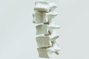 osteoporosi abbassamento statura